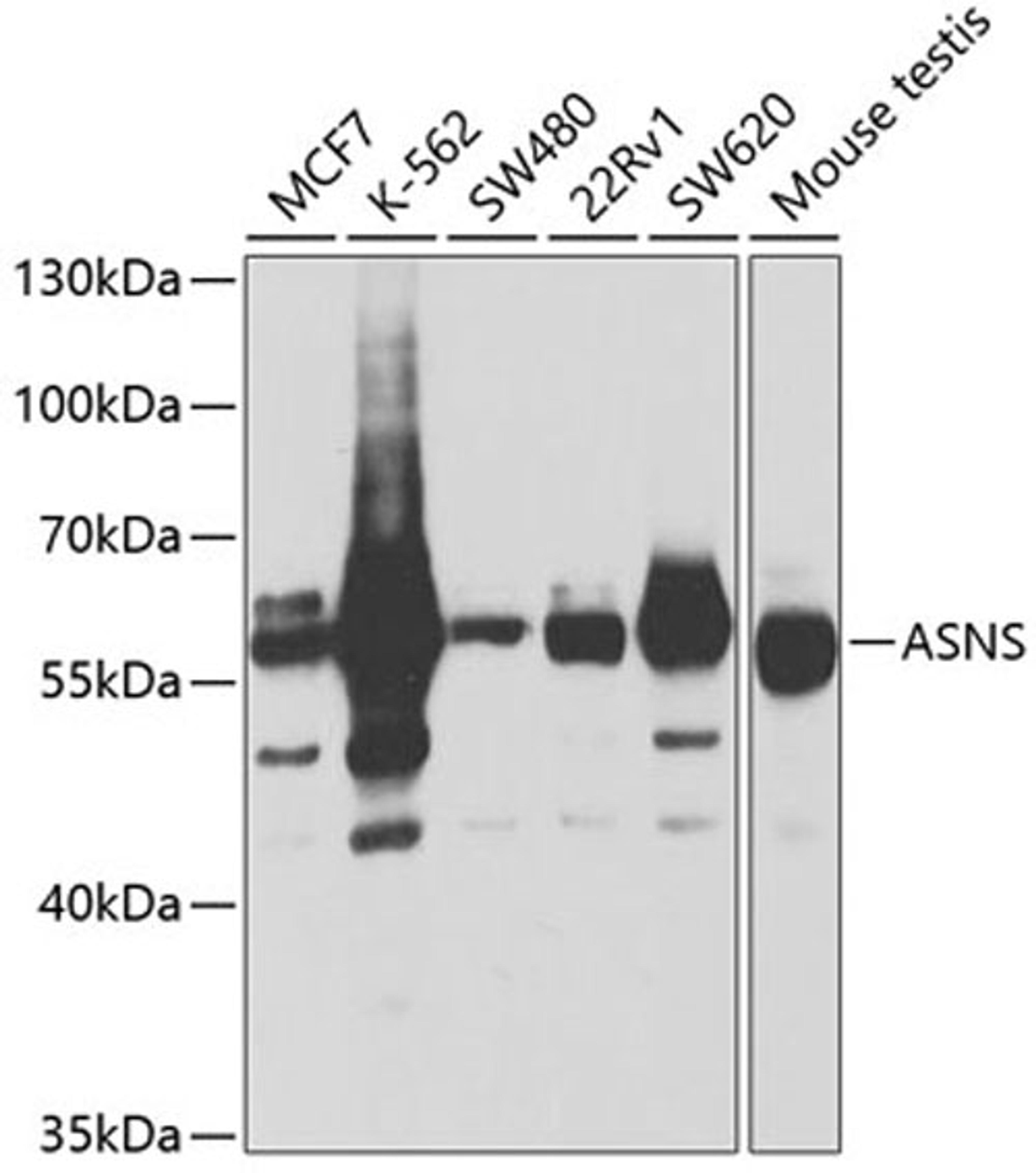 Western blot - ASNS antibody (A5558)