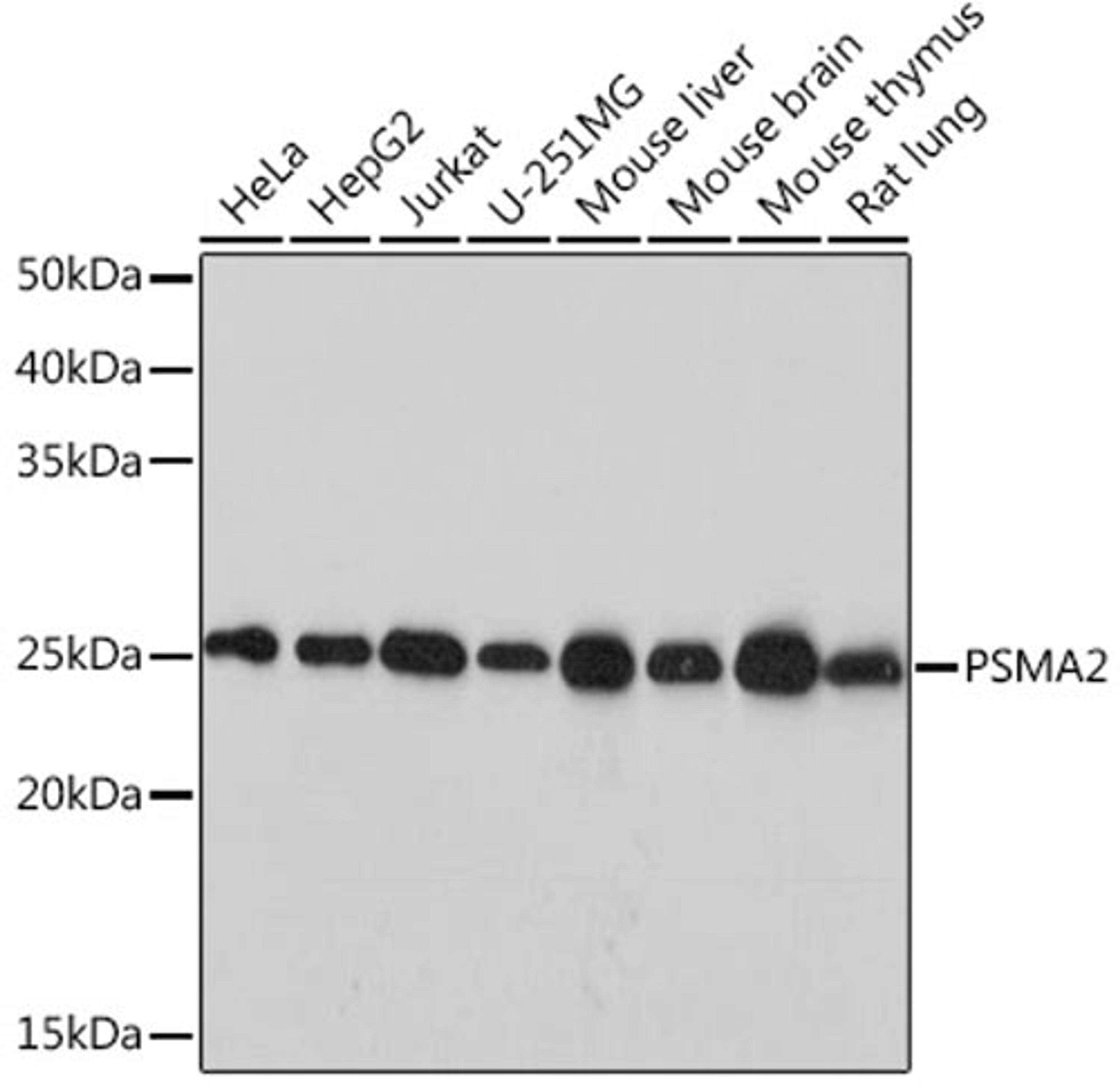 Western blot - PSMA2 Rabbit mAb (A9182)