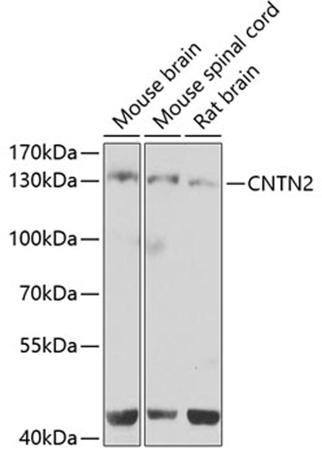 Western blot - CNTN2 antibody (A7738)