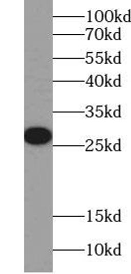 Western blot analysis of HEK-293 cells lysates using ERAB Antibody (dilution at 1:2000)