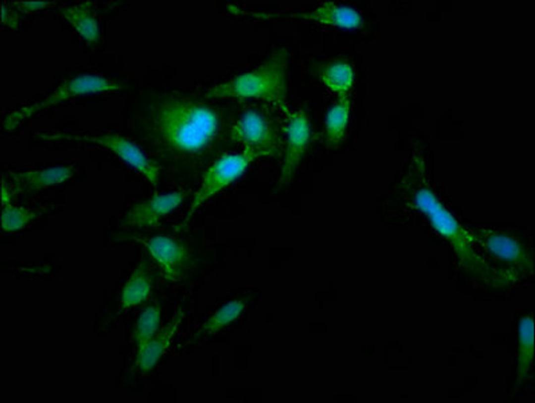 Immunofluorescence staining of Hela cells with CSB-PA614887LA01HU at 1:185, counter-stained with DAPI. The cells were fixed in 4% formaldehyde, permeabilized using 0.2% Triton X-100 and blocked in 10% normal Goat Serum. The cells were then incubated with the antibody overnight at 4°C. The secondary antibody was Alexa Fluor 488-congugated AffiniPure Goat Anti-Rabbit IgG(H+L).