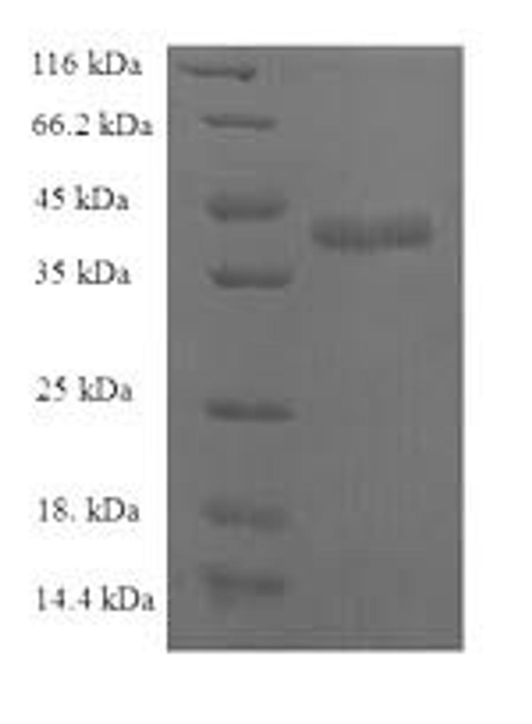 (Tris-Glycine gel) Discontinuous SDS-PAGE (reduced) with 5% enrichment gel and 15% separation gel.
