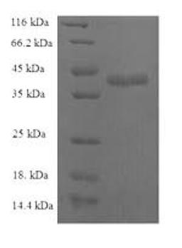 (Tris-Glycine gel) Discontinuous SDS-PAGE (reduced) with 5% enrichment gel and 15% separation gel.