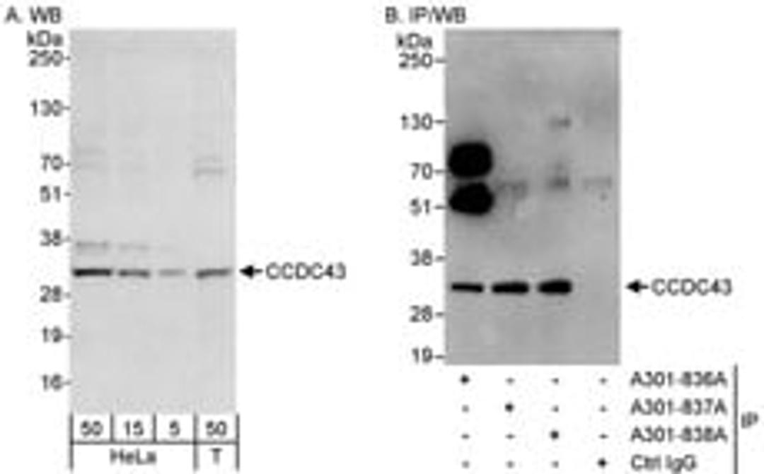 Detection of human CCDC43 by western blot and immunoprecipitation.