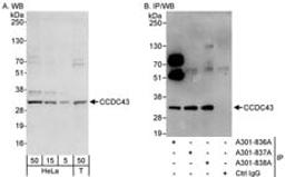 Detection of human CCDC43 by western blot and immunoprecipitation.