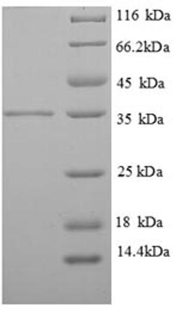 (Tris-Glycine gel) Discontinuous SDS-PAGE (reduced) with 5% enrichment gel and 15% separation gel.