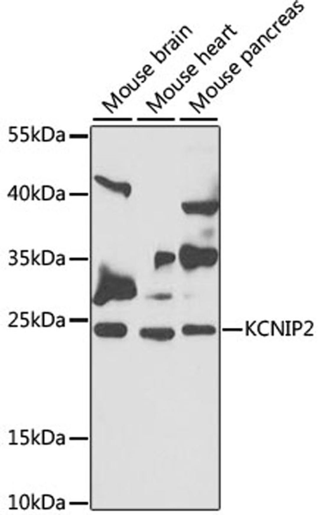 Western blot - KCNIP2 antibody (A7100)