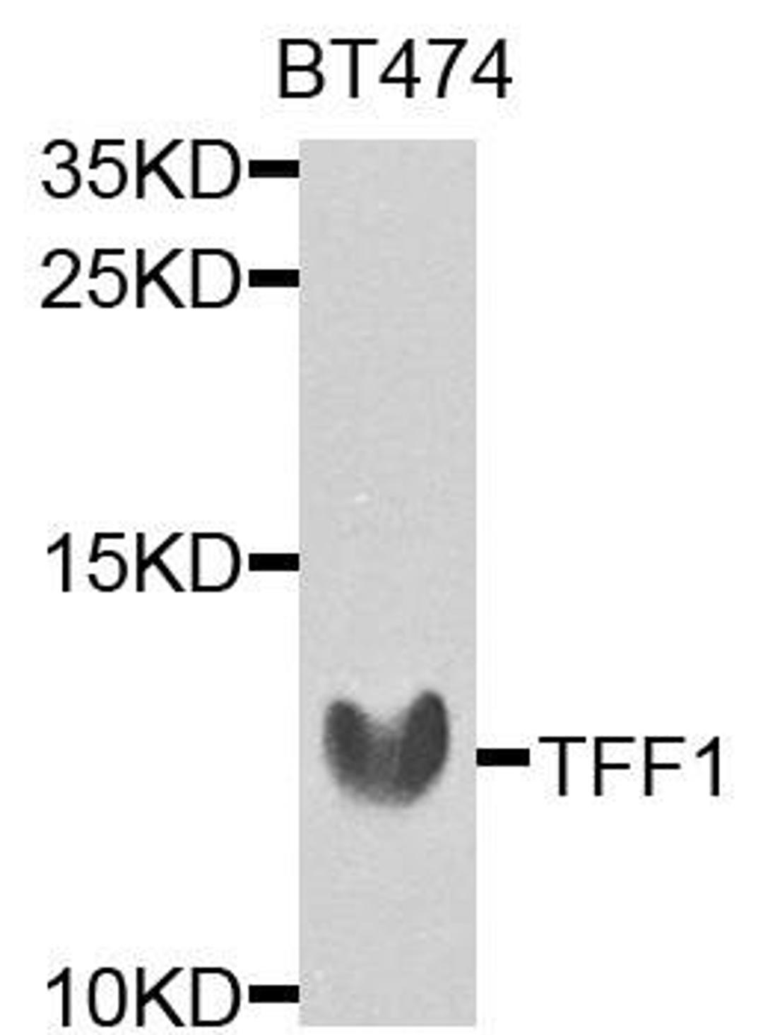 Western blot analysis of extracts of BT474 cells using TFF1 antibody