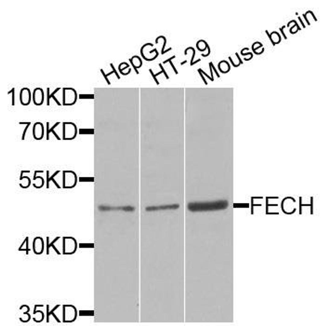 Western blot analysis of extracts of various cells using FECH antibody