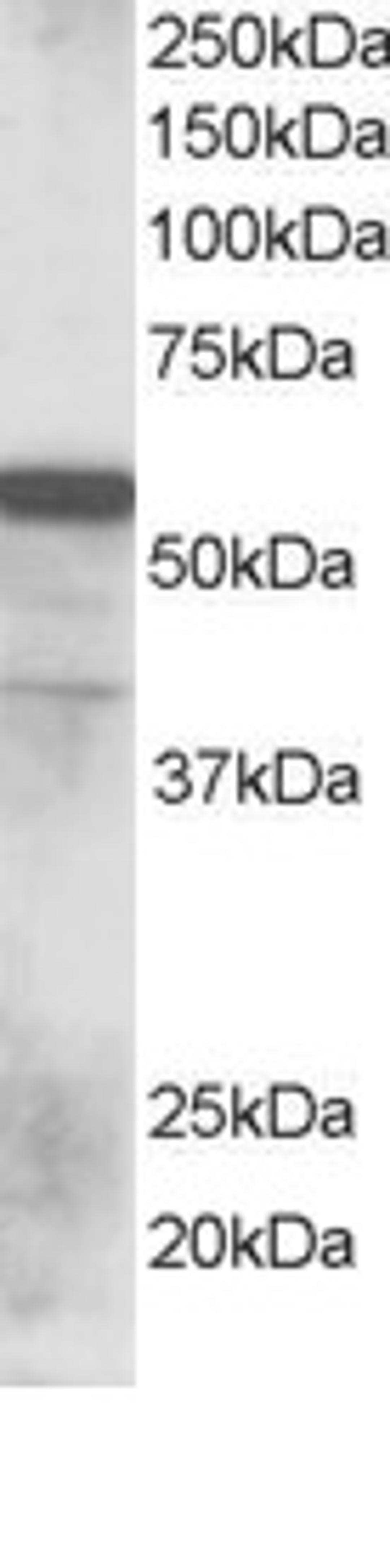 46-313 staining (0.1ug/ml) of Human Lung lysate (RIPA buffer, 35ug total protein per lane). Primary incubated for 1 hour. Detected by chemiluminescence.