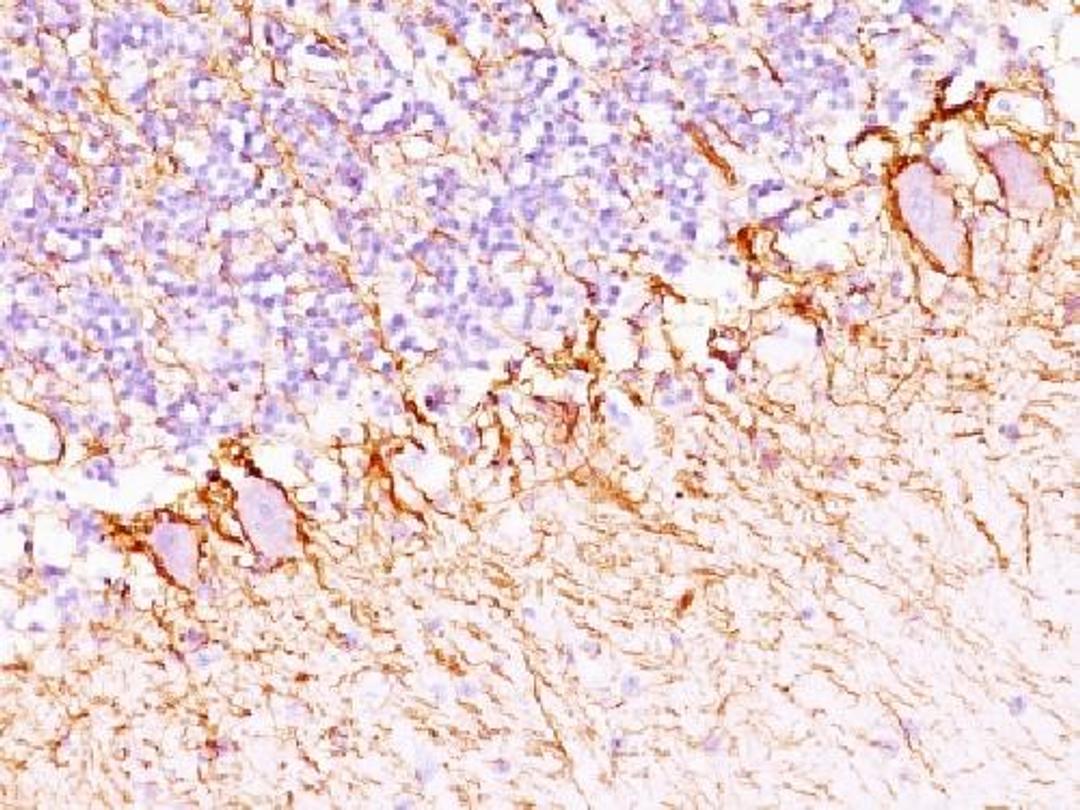 Immunohistochemical staining of human Cerebellum tissue using Neurofilament (H+L) antibody