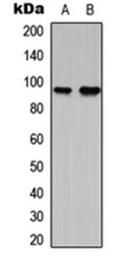 Western blot analysis of RT4 (Lane 1), NIH3T3 (Lane 2) whole cell lysates using G15 antibody