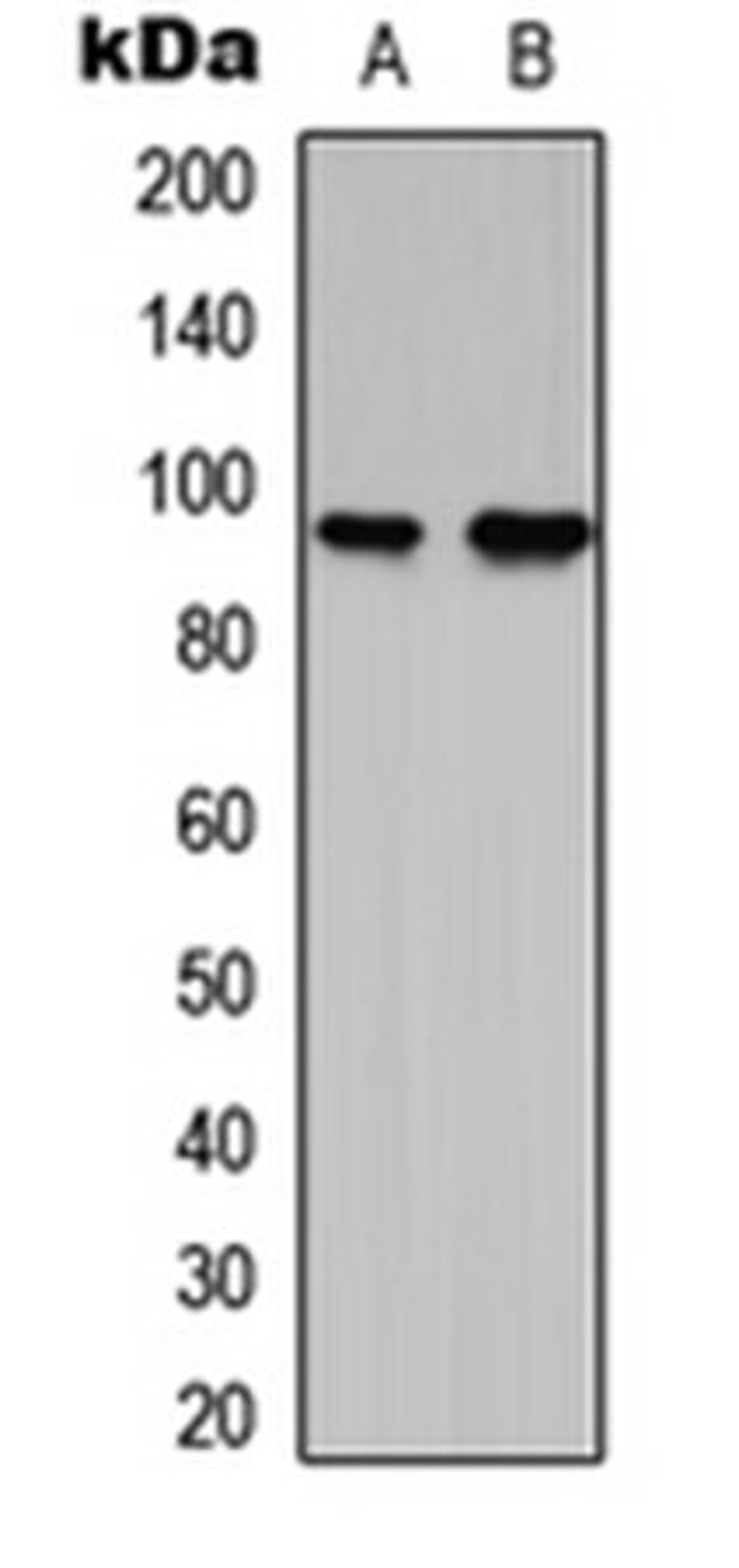 Western blot analysis of RT4 (Lane 1), NIH3T3 (Lane 2) whole cell lysates using G15 antibody