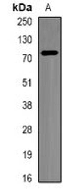 Western blot analysis of BT474 (Lane1) whole cell lysates using BTRC antibody