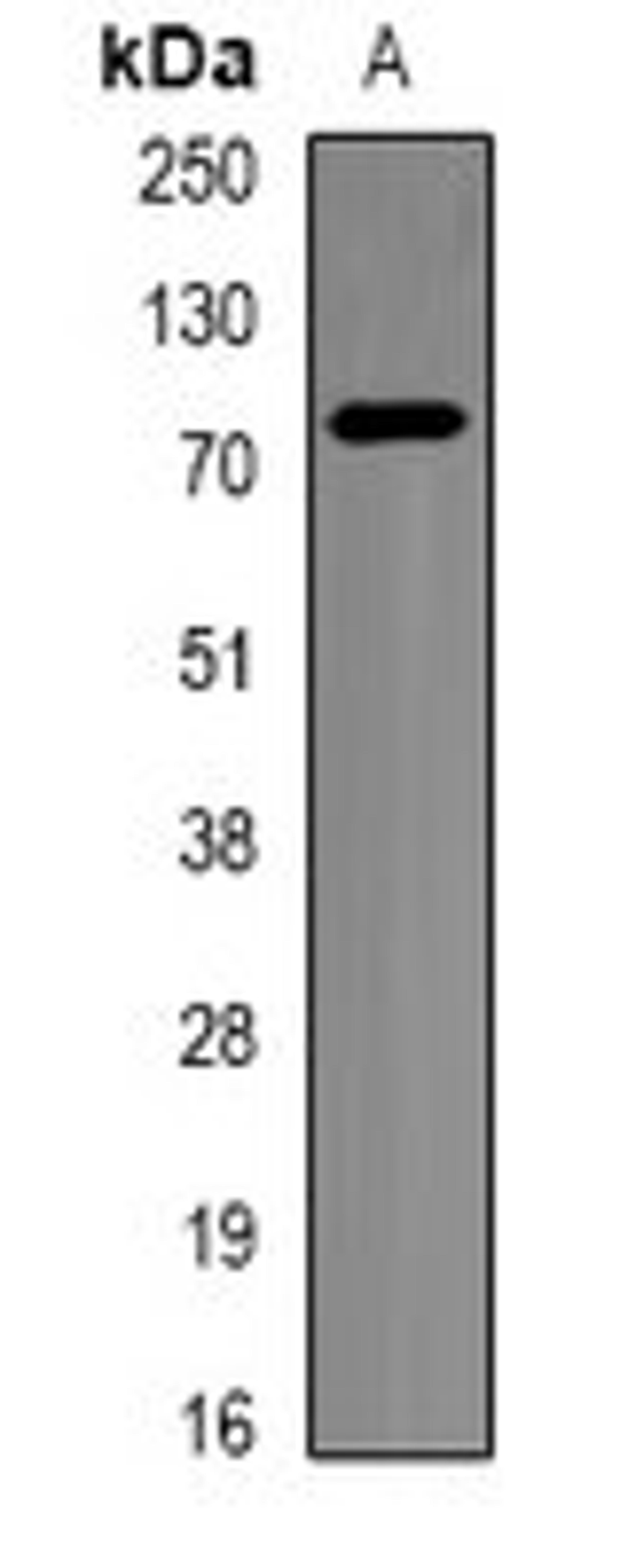 Western blot analysis of BT474 (Lane1) whole cell lysates using BTRC antibody