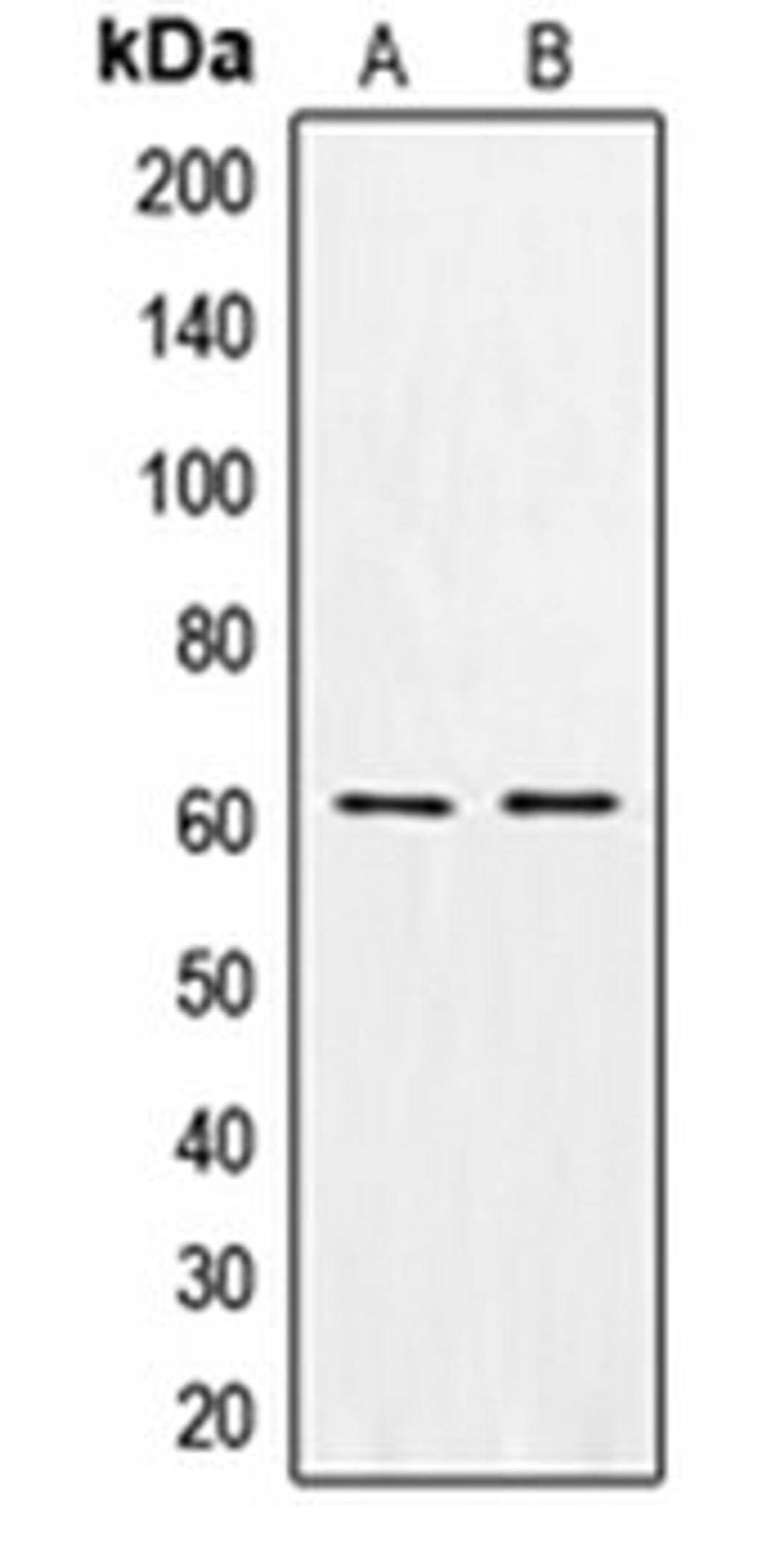 Western blot analysis of MCF7 (Lane 1), K562 (Lane 2) whole cell lysates using CSGALNACT1 antibody