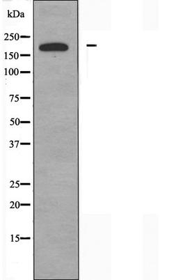 Western blot analysis of Jurkat cells using AS250 antibody