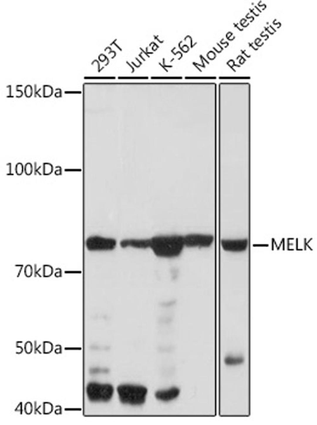 Western blot - MELK Rabbit mAb (A3530)
