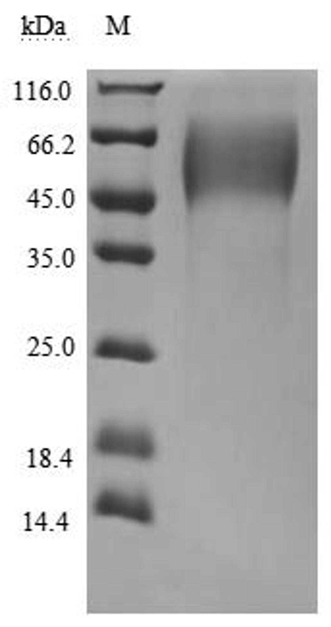 (Tris-Glycine gel) Discontinuous SDS-PAGE (reduced) with 5% enrichment gel and 15% separation gel.