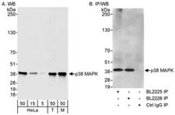 Detection of human and mouse p38 MAPK by western blot (h&m) and immunoprecipitation (h).