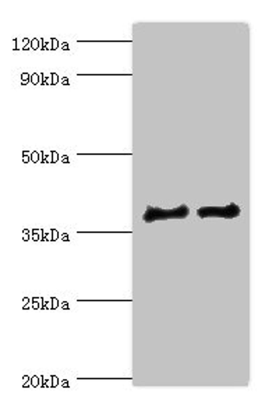 Western blot. All lanes: CTSV antibody at 12ug/ml. Lane 1: Jurkat whole cell lysate. Lane 2: MCF-7 whole cell lysate. Secondary. Goat polyclonal to rabbit IgG at 1/10000 dilution. Predicted band size: 37 kDa. Observed band size: 37 kDa. 