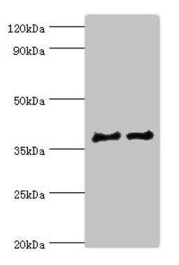Western blot. All lanes: CTSV antibody at 12ug/ml. Lane 1: Jurkat whole cell lysate. Lane 2: MCF-7 whole cell lysate. Secondary. Goat polyclonal to rabbit IgG at 1/10000 dilution. Predicted band size: 37 kDa. Observed band size: 37 kDa. 