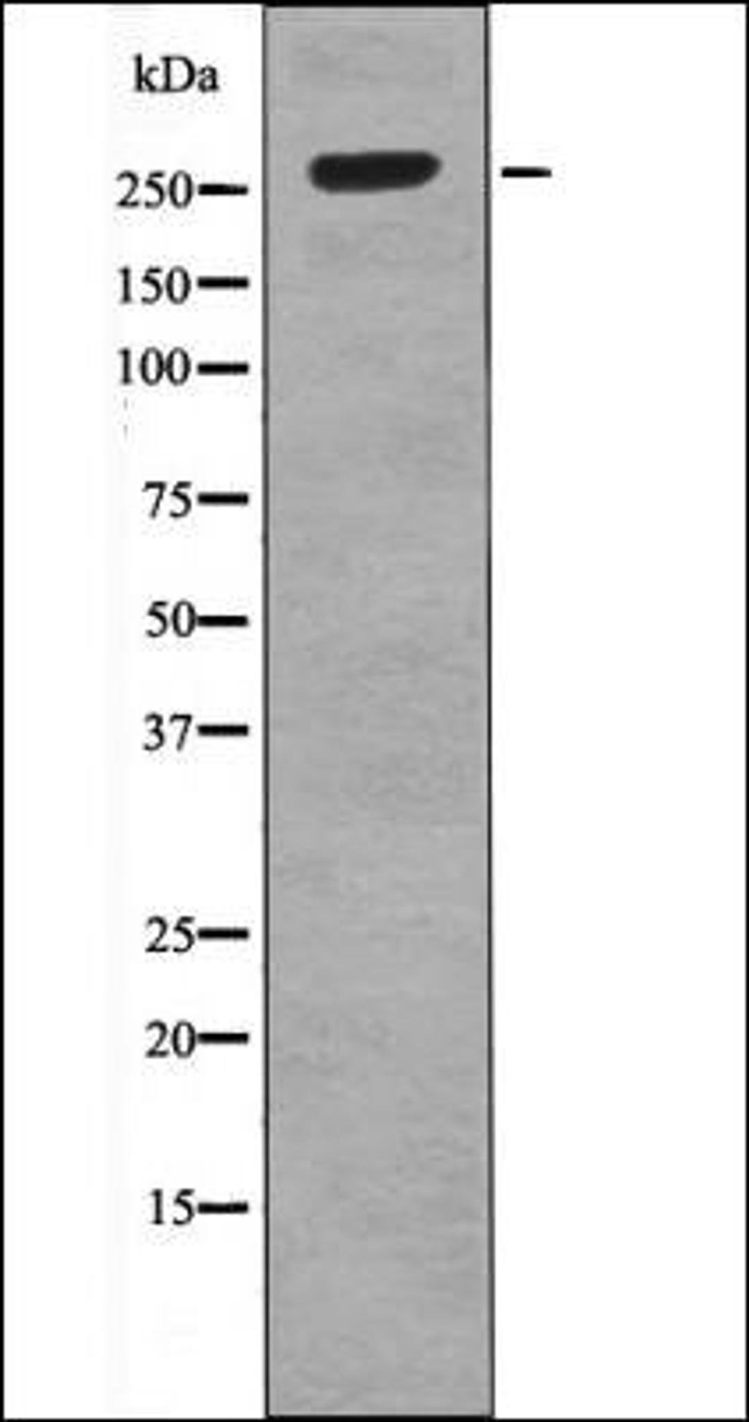 Western blot analysis of IL-4 treated HeLa whole cell lysates using ROS -Phospho-Tyr2274- antibody