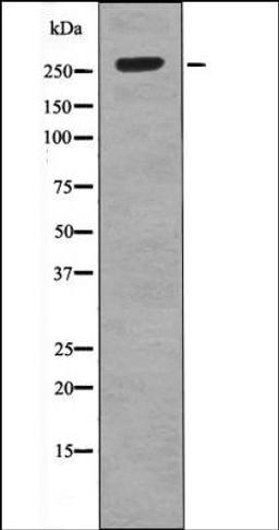 Western blot analysis of IL-4 treated HeLa whole cell lysates using ROS -Phospho-Tyr2274- antibody