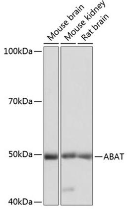 Western blot - ABAT Polyclonal Antibody (A5299)