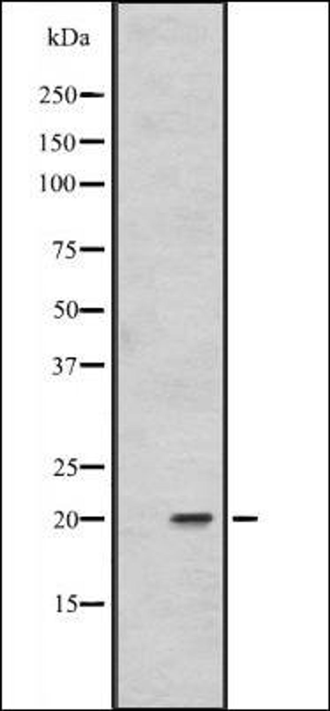 Western blot analysis of 293T whole cell lysate using FAIM1 antibody