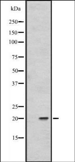 Western blot analysis of 293T whole cell lysate using FAIM1 antibody