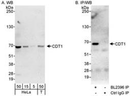 Detection of human CDT1 by western blot and immunoprecipitation.