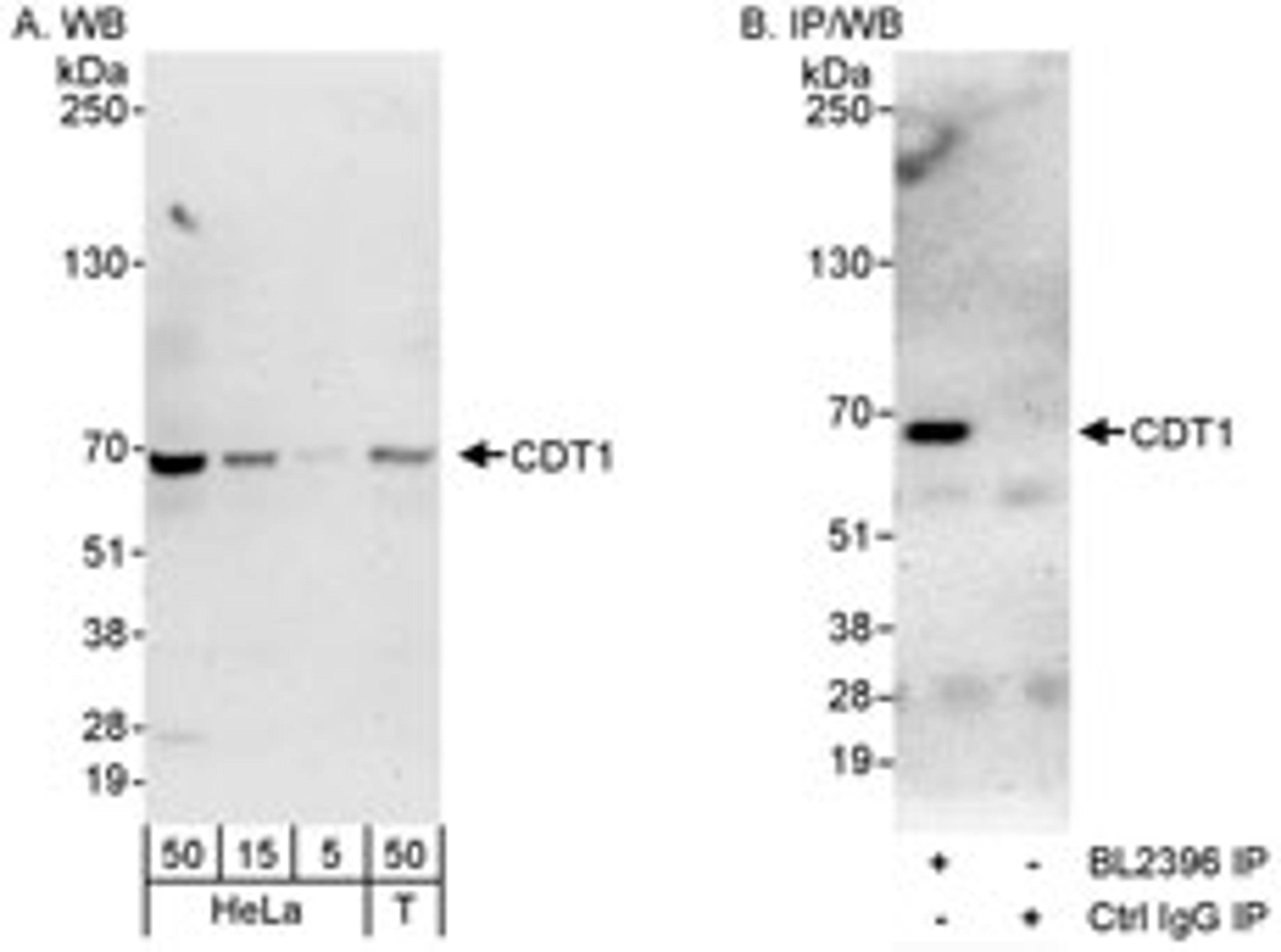 Detection of human CDT1 by western blot and immunoprecipitation.