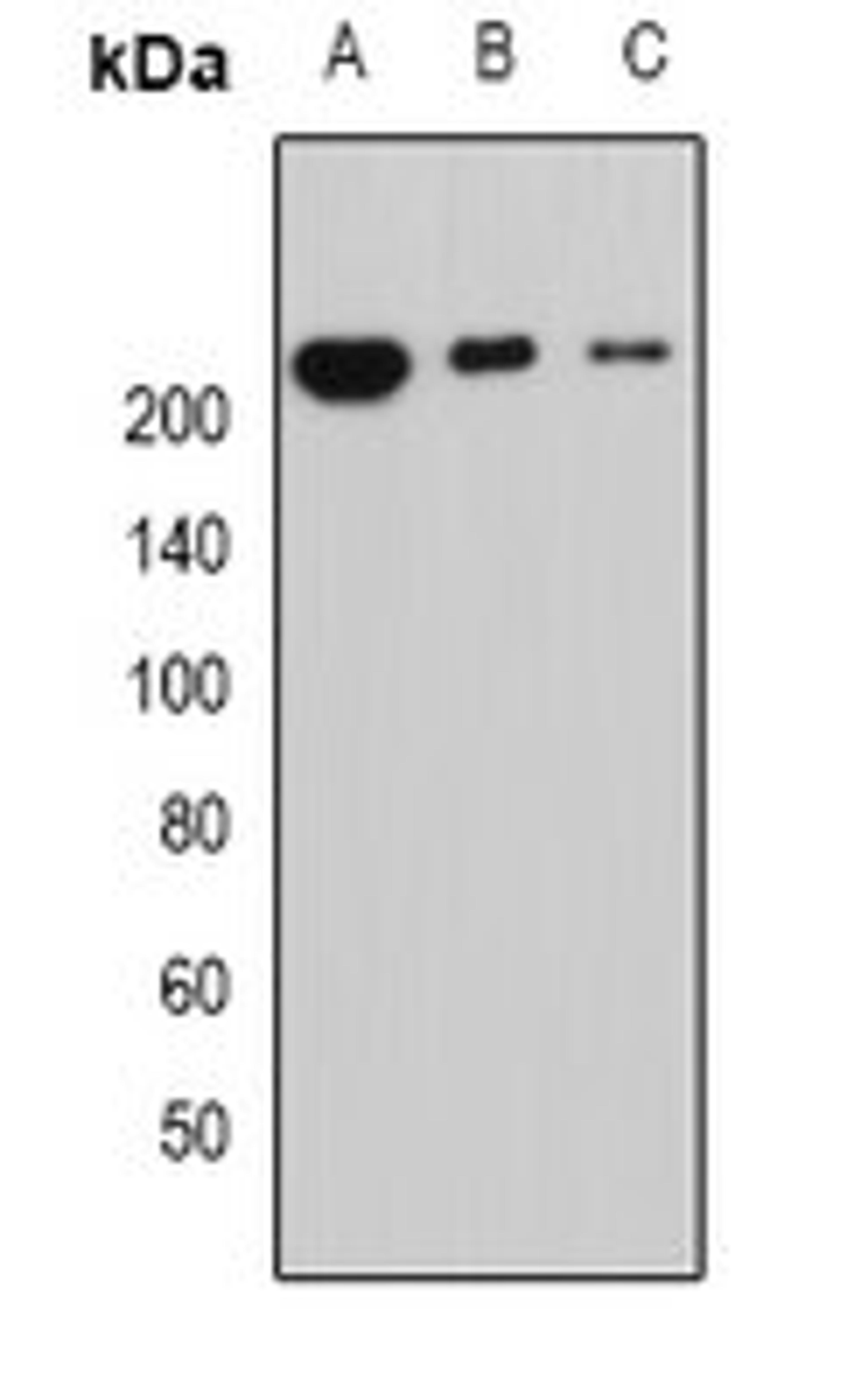 Western blot analysis of MCF7 (Lane1), mouse lung (Lane2), mouse heart (Lane3) whole cell lysates using PPL antibody