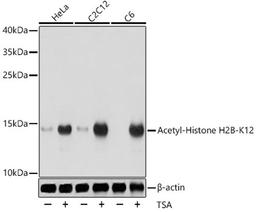 Western blot - Acetyl-Histone H2B-K12 antibody (A15619)