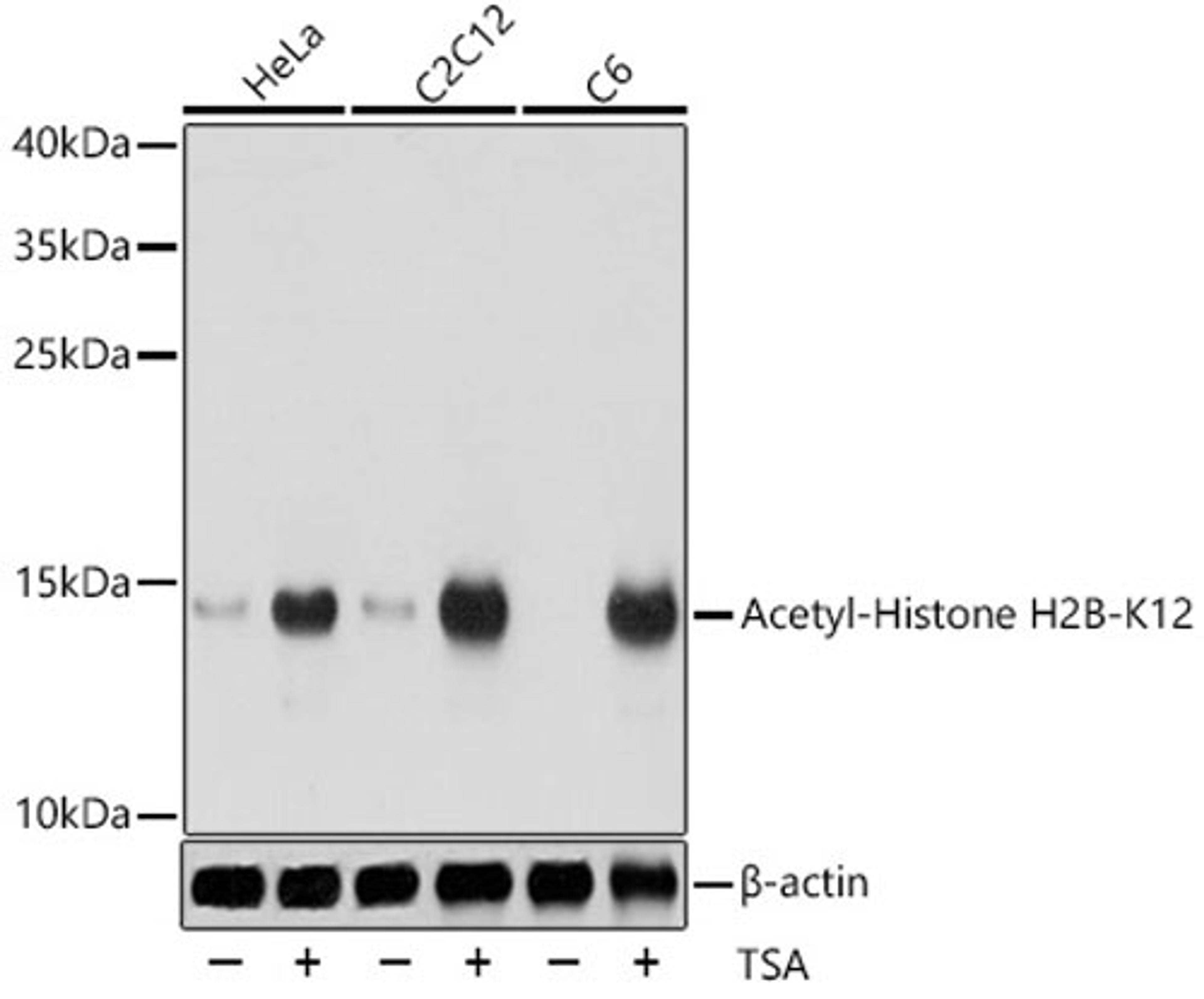 Western blot - Acetyl-Histone H2B-K12 antibody (A15619)