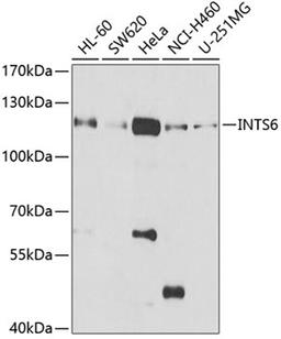 Western blot - INTS6 antibody (A6634)