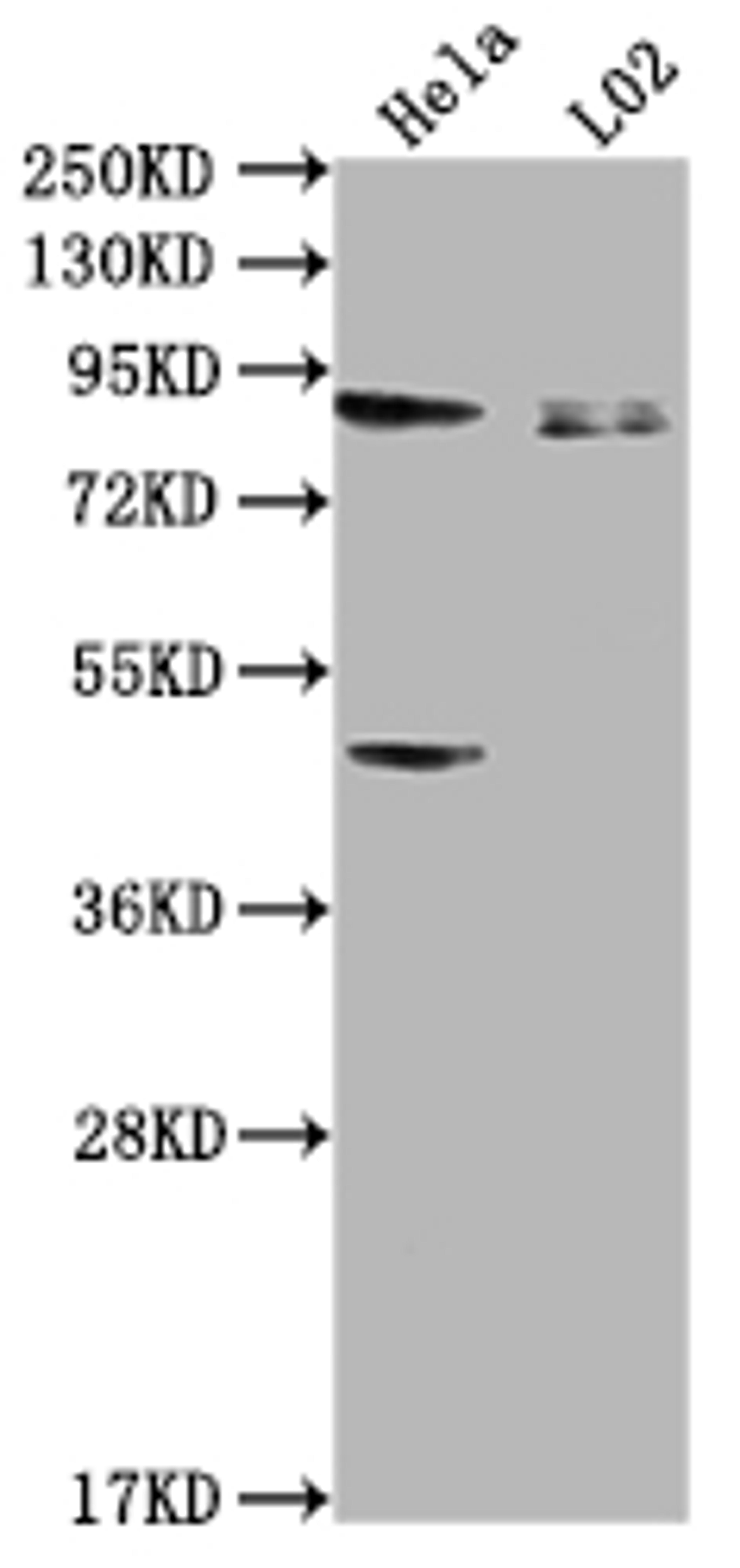 Western Blot. Positive WB detected in: Hela whole cell lysate, L02 whole cell lysate. All lanes: PIBF1 antibody at 1:2000. Secondary. Goat polyclonal to rabbit IgG at 1/50000 dilution. Predicted band size: 90, 26, 13, 36 kDa. Observed band size: 90 kDa. 
