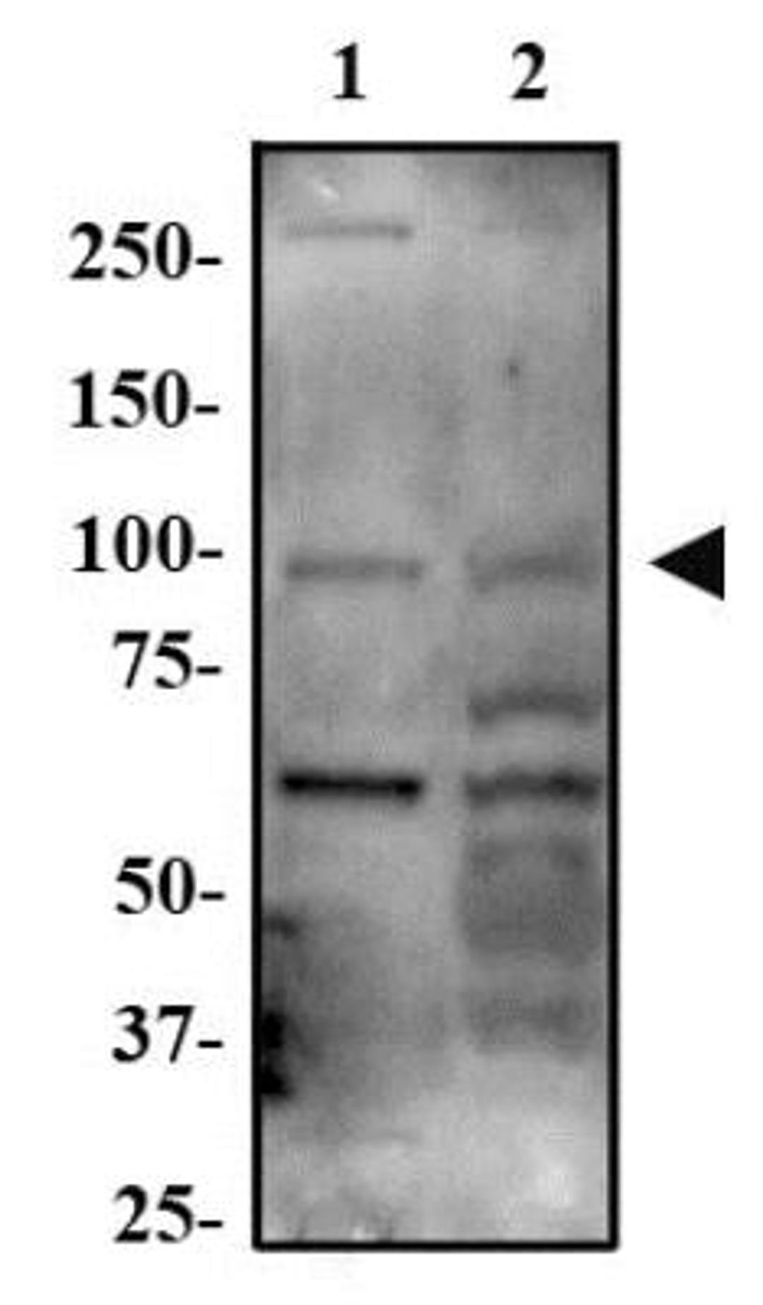 Western Blot: RhoGap12 Antibody [NBP2-23690] - Western Blot Image of anti-RhoGap12. Whole cell protein from A549 (lane 1), MCF7 (lane 2) and HepG2 (lane 3) was separated on a 7.5% gel by SDS-PAGE, transferred to PVDF membrane and blocked in 5% non-fat milk in TBST. The membrane was probed with a 1:500 dilution of anti-RhoGap12 in 1% milk and detected with an anti-rabbit HRP secondary antibody using chemiluminescence.