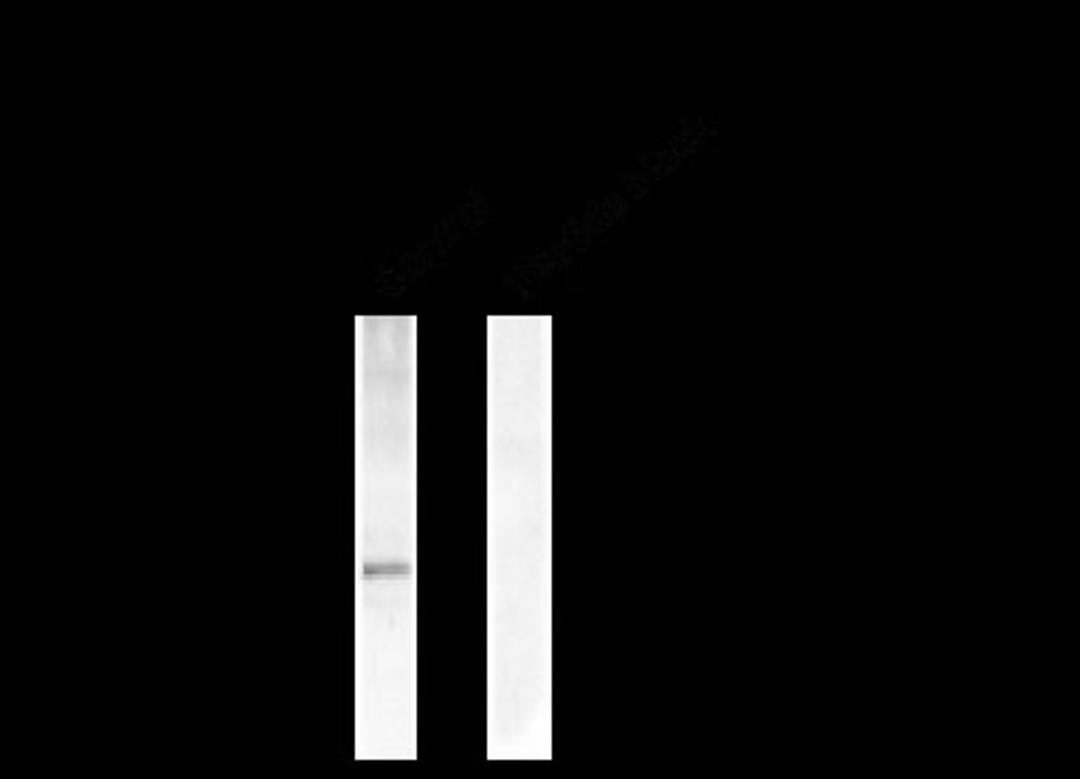 Western blot of human T47D cells showing phospho-specific immunolabeling of the ~42k-44k ERK/MAPK protein doublet.