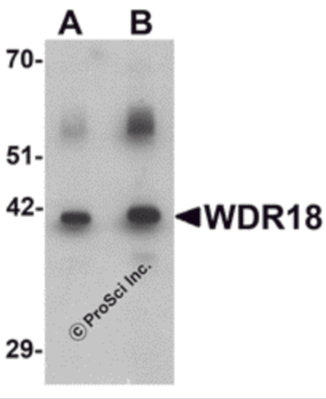 Western blot analysis of WDR18 in rat lung tissue lysate with WDR18 antibody at (A) 1 and (B) 2 μg/mL.