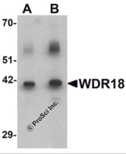 Western blot analysis of WDR18 in rat lung tissue lysate with WDR18 antibody at (A) 1 and (B) 2 μg/mL.
