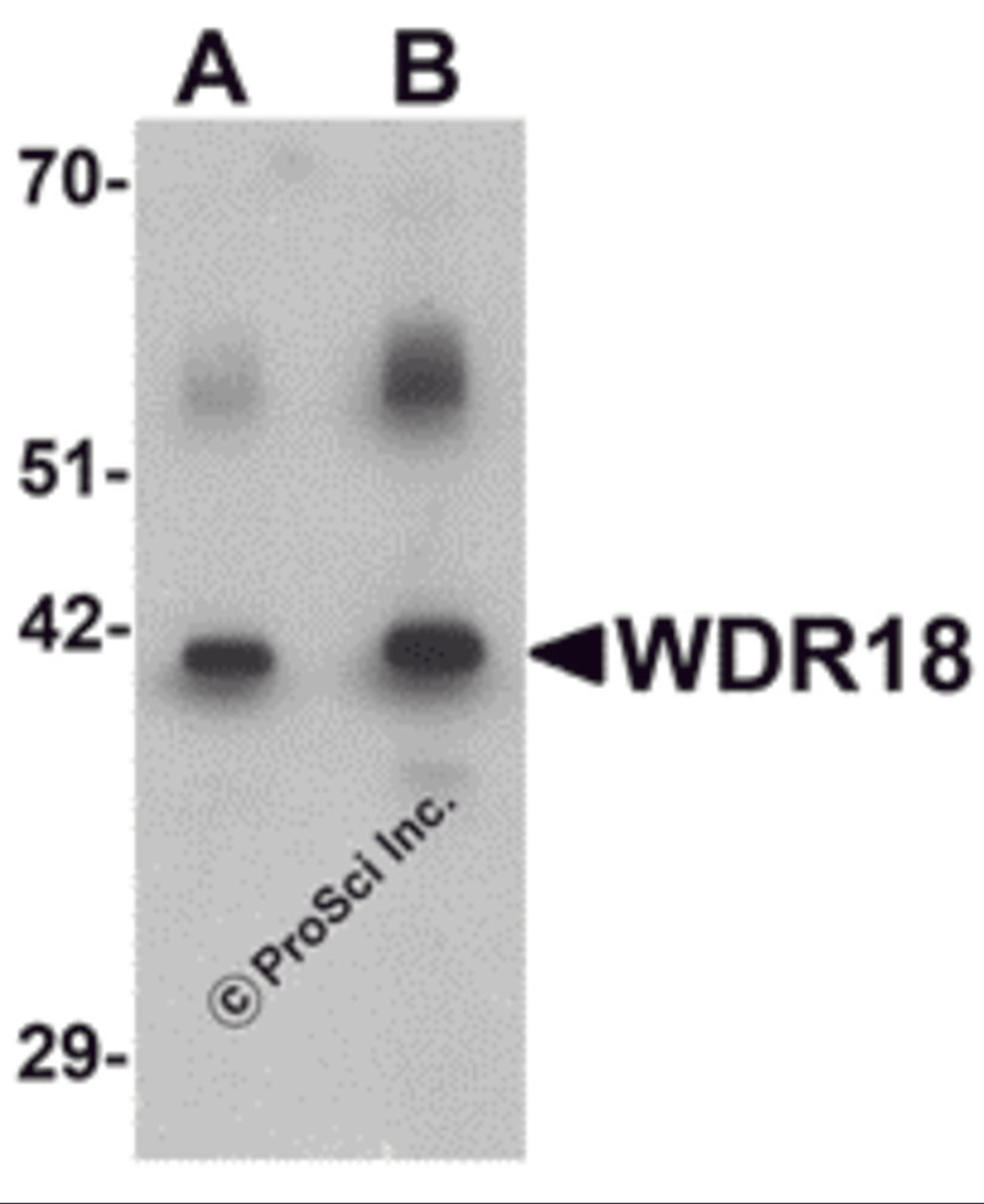 Western blot analysis of WDR18 in rat lung tissue lysate with WDR18 antibody at (A) 1 and (B) 2 μg/mL.