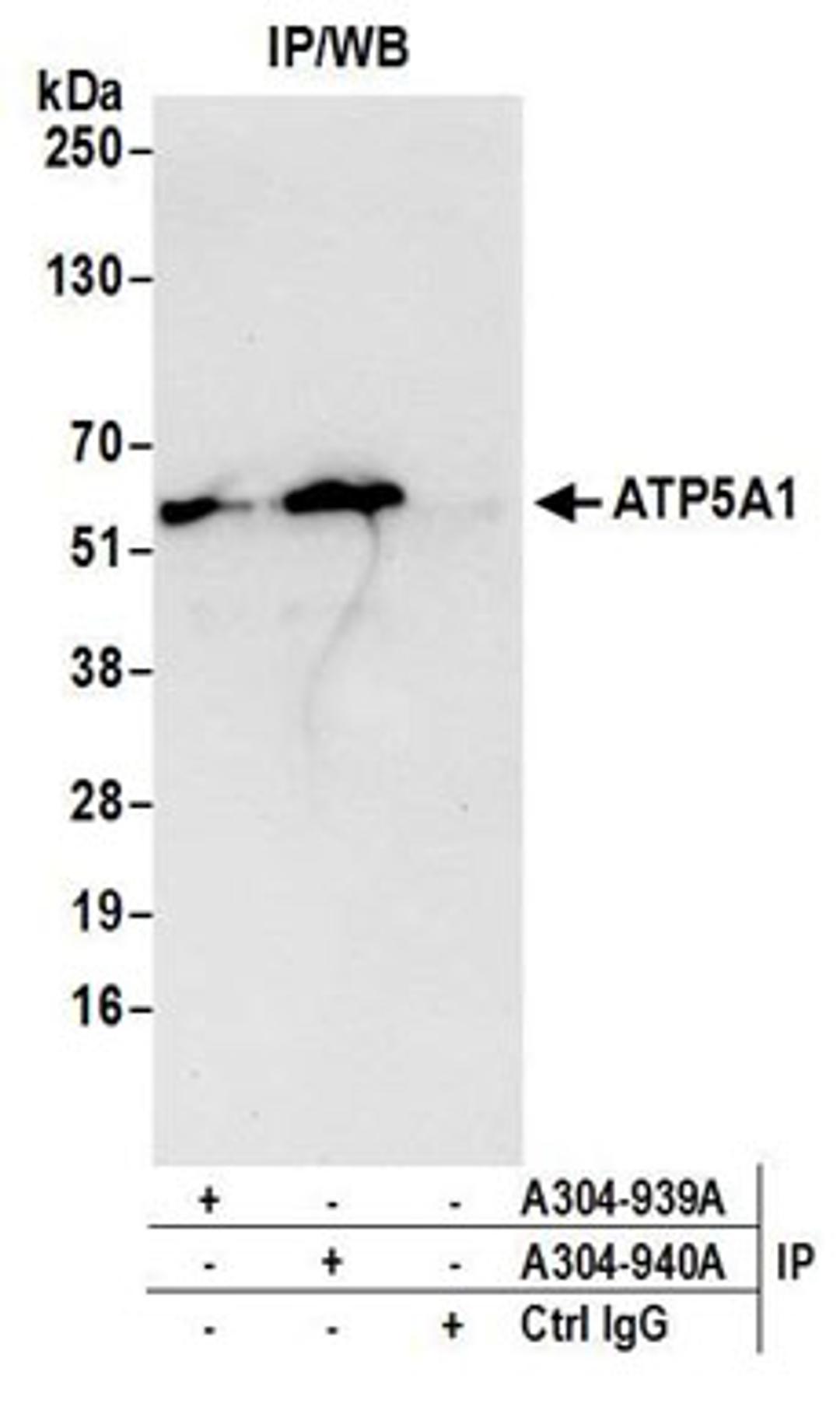 Detection of human ATP5A1 by western blot of immunoprecipitates.