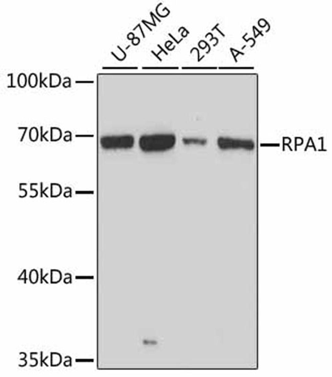 Western blot - RPA1 antibody (A0874)