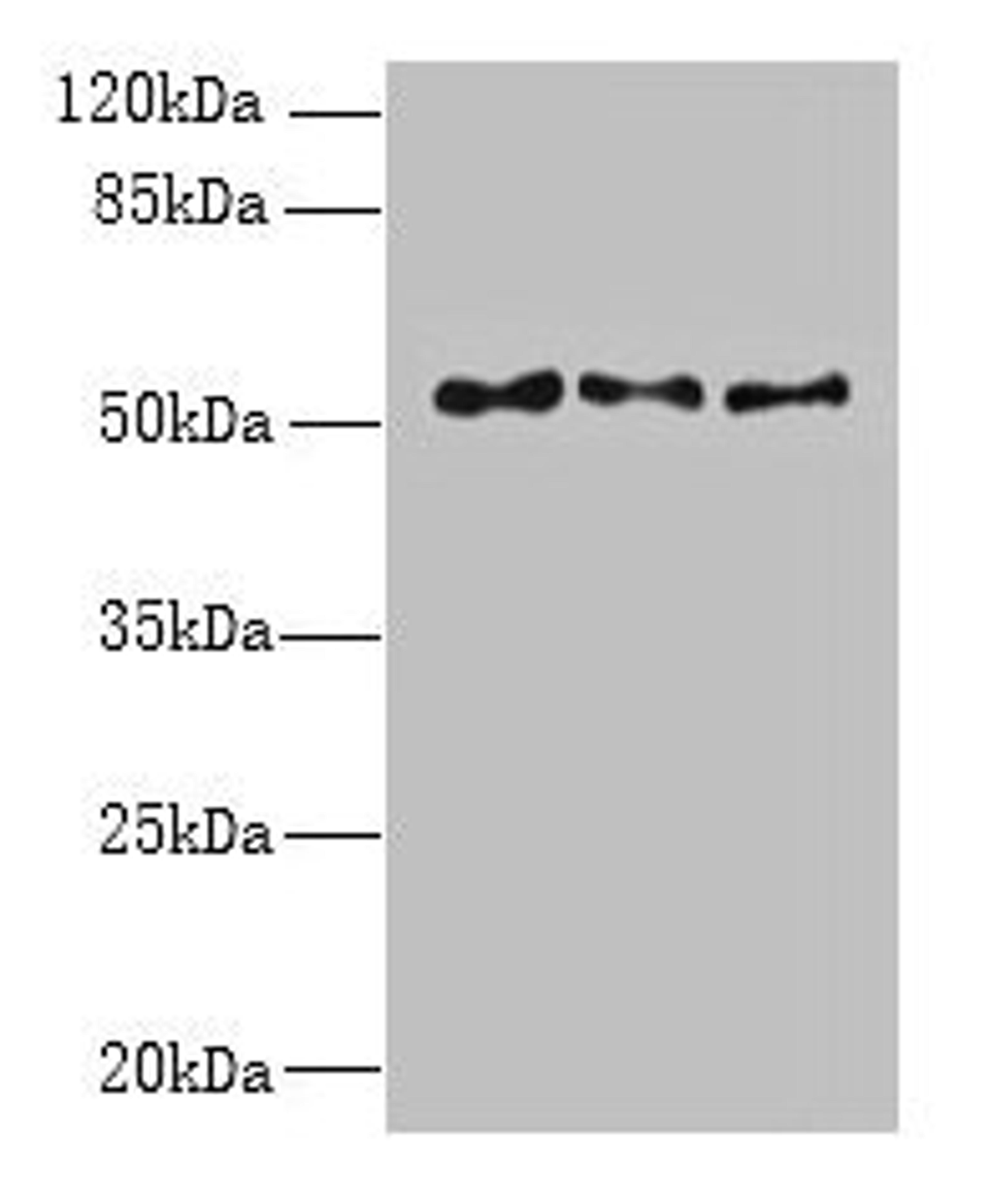 Western blot. All lanes: TRIML1 antibody at 3µg/ml. Lane 1: Mouse kidney tissue. Lane 2: Human placenta tissue. Lane 3: A431 whole cell lysate. Secondary. Goat polyclonal to rabbit IgG at 1/10000 dilution. Predicted band size: 54 kDa. Observed band size: 54 kDa