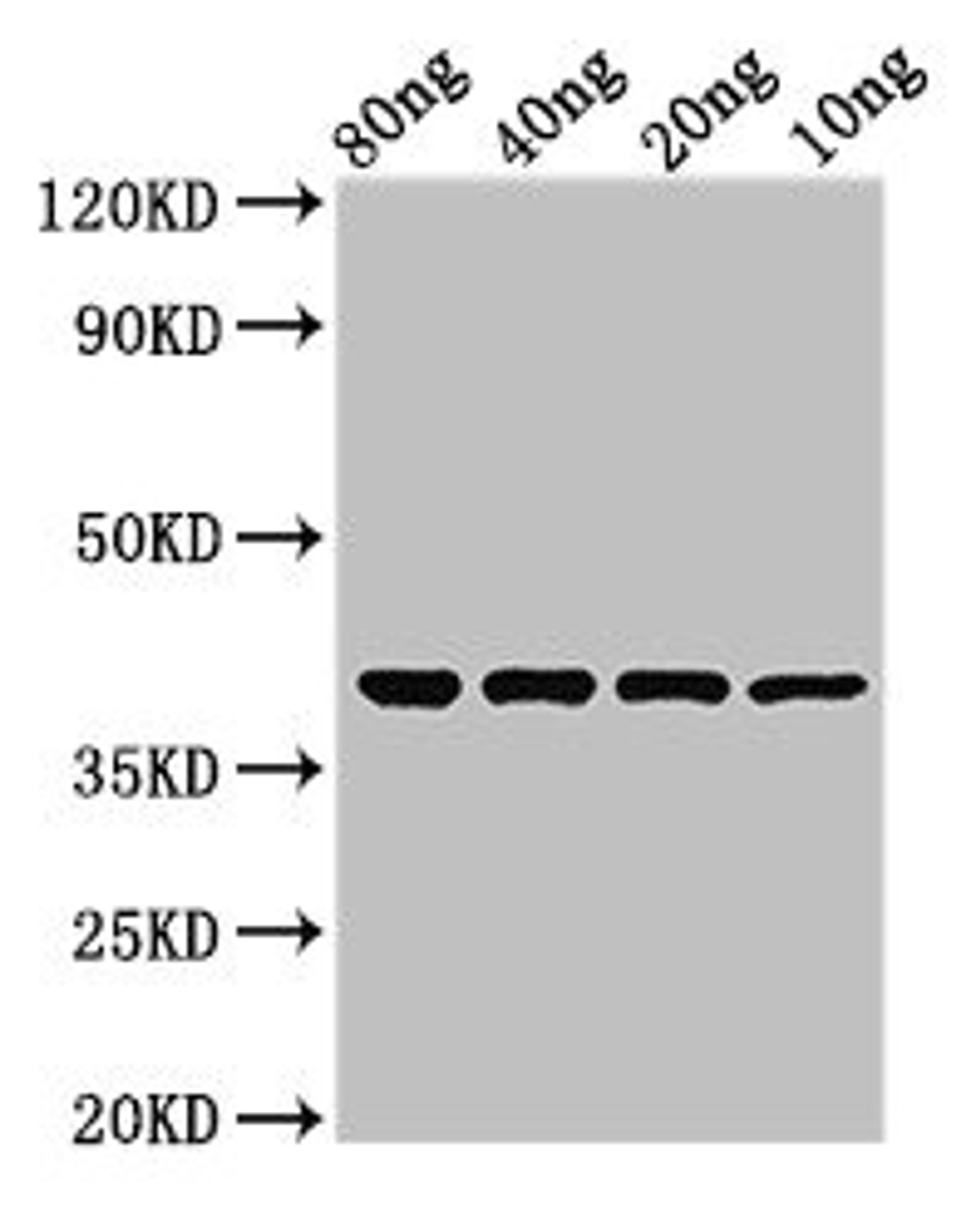Western Blot. Positive WB detected in Recombinant protein. All lanes: ompT antibody at 2.4µg/ml. Secondary. Goat polyclonal to rabbit IgG at 1/50000 dilution. predicted band size: 38 kDa. observed band size: 38 kDa