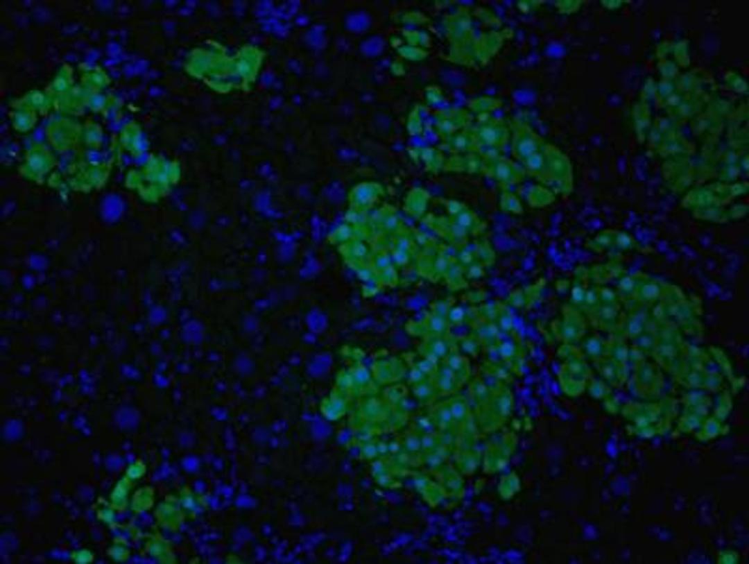 Immunocytochemistry/Immunofluorescence: GFP Antibody [NB600-308] - Analysis of GFP in rat liver. Image courtesy of an anonymous customer review.