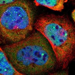 Immunocytochemistry/Immunofluorescence: p57 Kip2 Antibody [NBP1-89917] - Staining of human cell line A-431 shows positivity in nucleus but not nucleoli & cytoplasm.