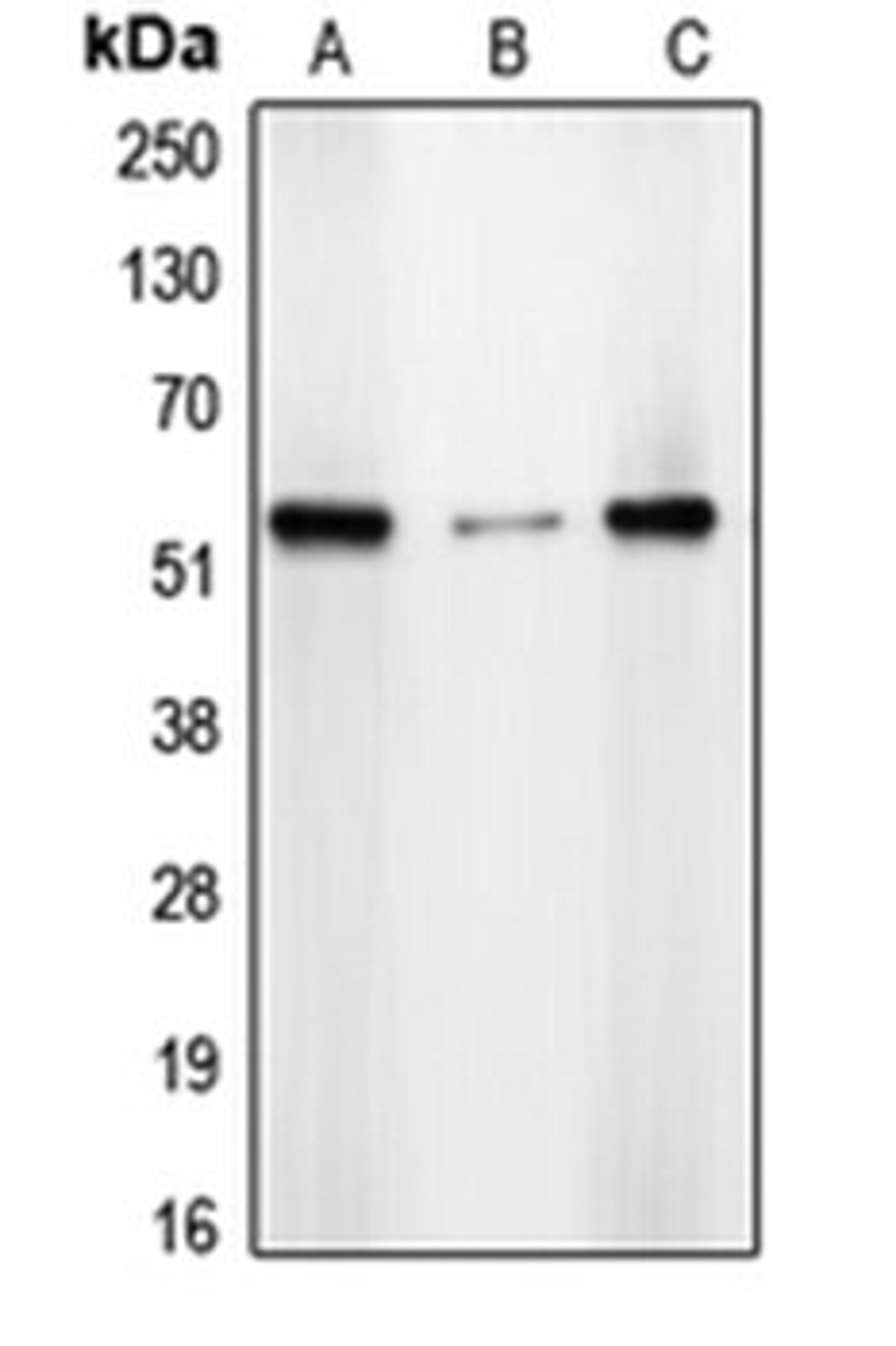 Western blot analysis of A431 (Lane 1), HepG2 (Lane 2), HeLa (Lane 3) whole cell lysates using CDYL2 antibody